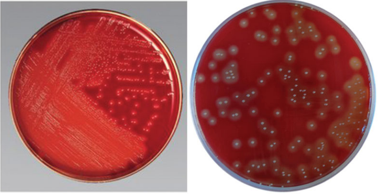 محیط کشت Streptococcus Selective